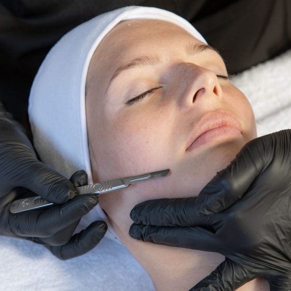 Dermaplanning