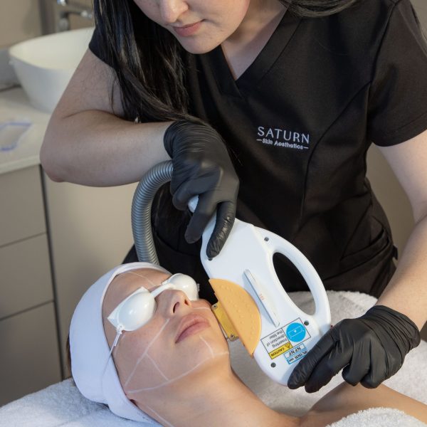 IPL Photo Rejuvenation / Pigmentation/Vascular /Acne Management/Vascular /Acne Management